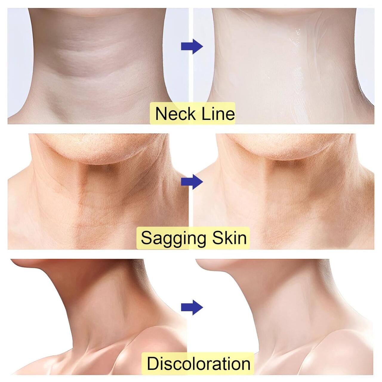 Crema Antienvejecimiento Cuello y Escote 💖Rejuvenecedora Total
